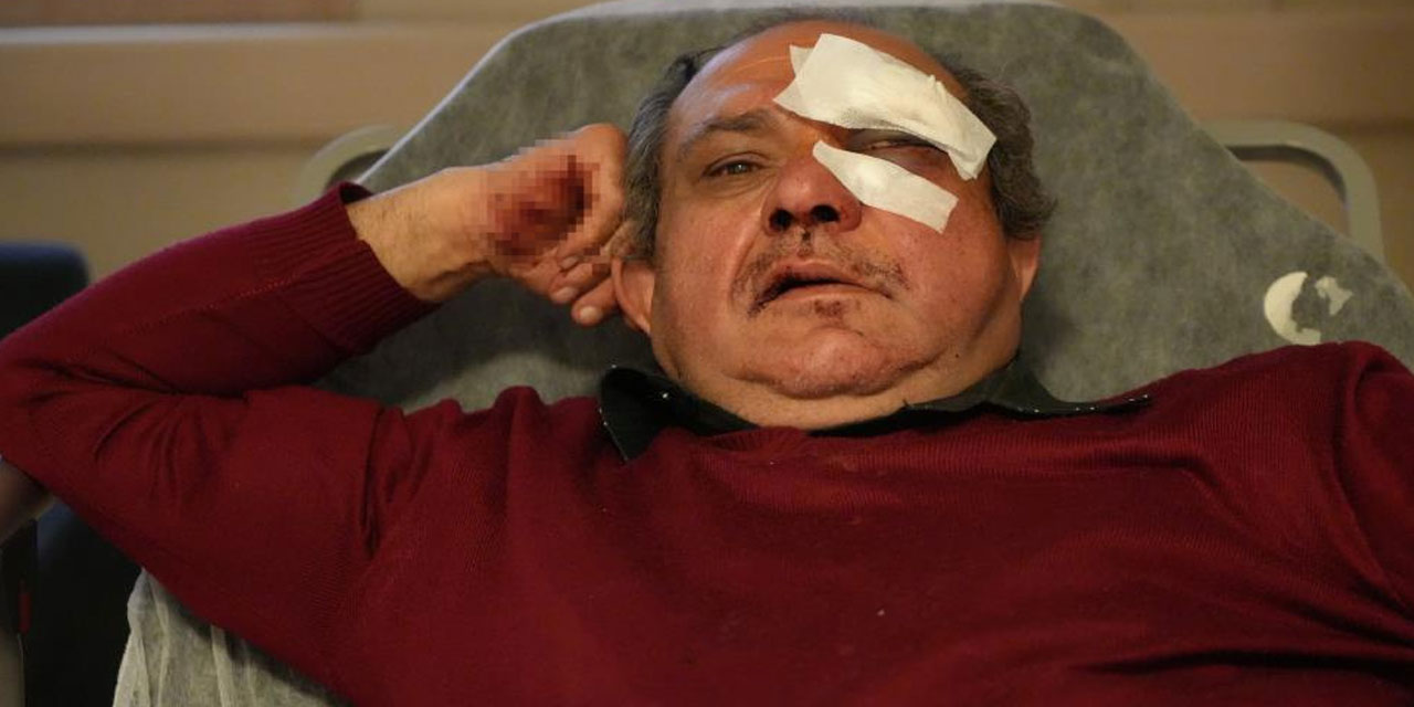 Aile Sağlığı Merkezi önünde darp edilen doktor hastanelik oldu: "Bu muamele hakkımız değil"
