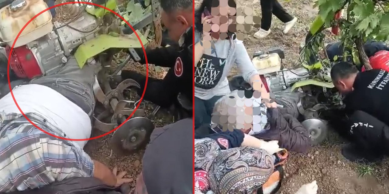 Kırıkkale'de vatandaş  bacağını çapa makinesine kaptırdı