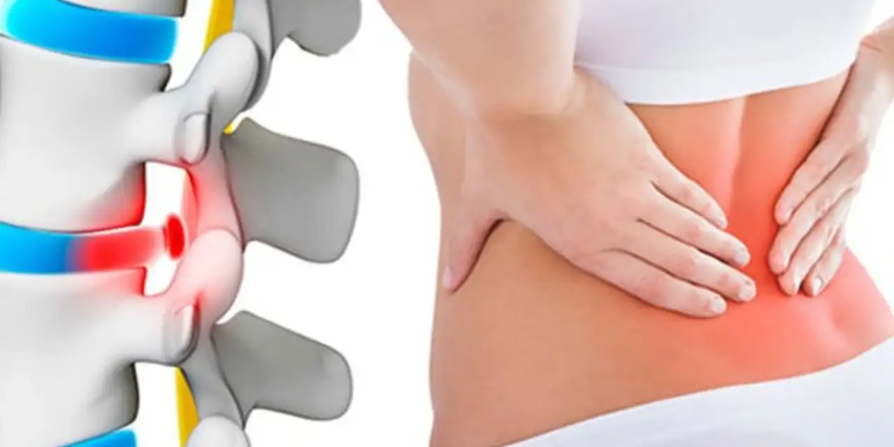 Kadınlarda gizli tehlike! Ev işleri ve duygusal yük bel fıtığını tetikliyor