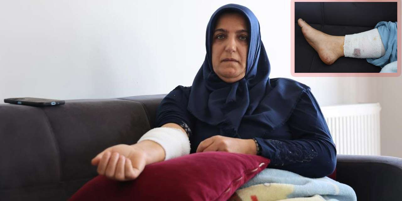 Kırıkkaleli öğrenci okuluna gidemeden annesi hastanelik oldu: Terminalde kan donduran köpek saldırısı