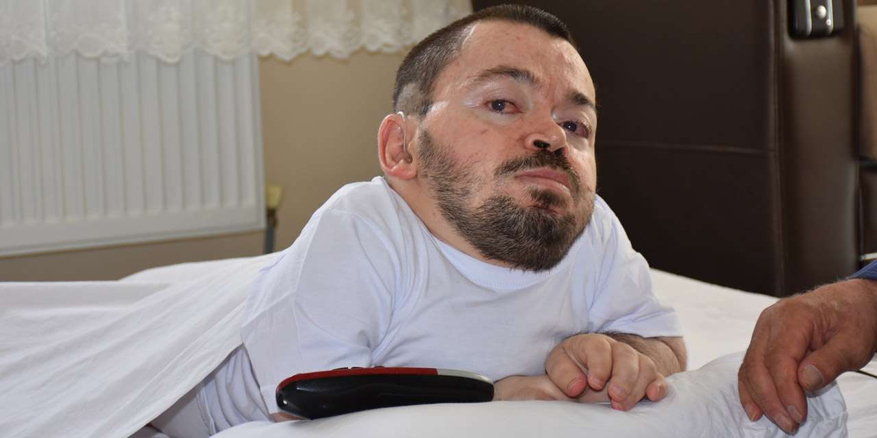 Tıbbi müdahale bile yapılamıyor ama o pes etmedi: Kırıkkaleli Mico’nun ilham veren hikayesi